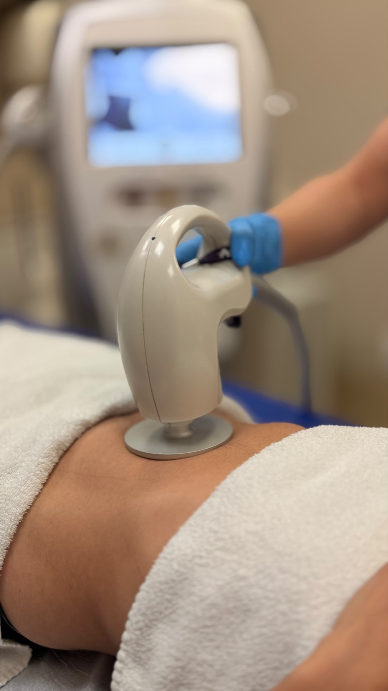 Ponteira de ultrassom do AlmaPrime aplicada na região abdominal, com o equipamento ao fundo